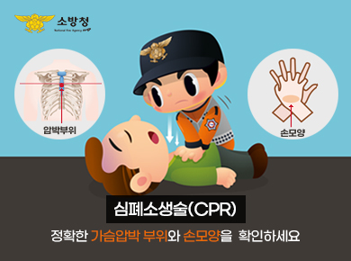 심폐소생술